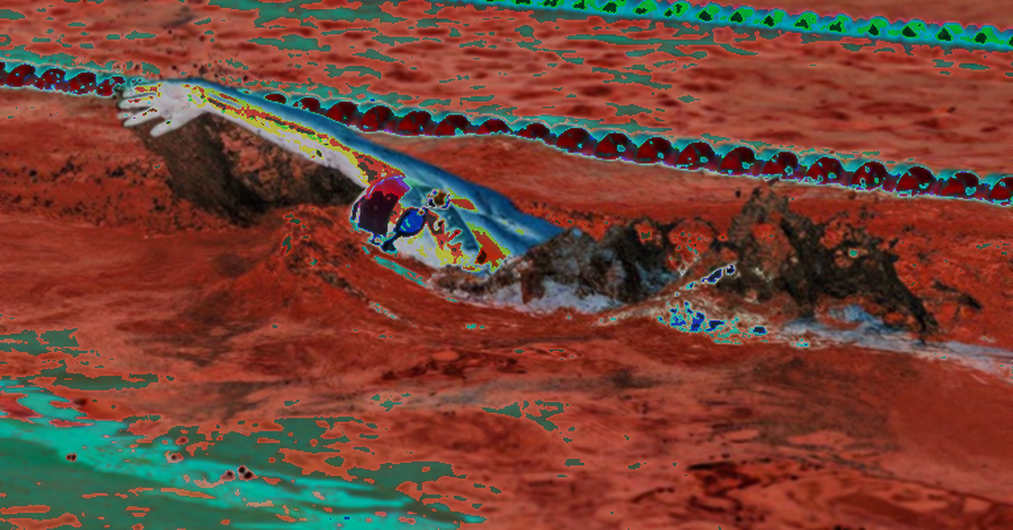 The Blank Lane: When Vietnamese Swimming Has No Injury Data to Read